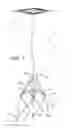Fig. 02 - Percutaneous heart valve prosthesis