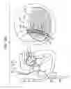 Fig. 06 - Closure element for use with annuloplasty structure