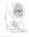 Fig. 07 - Closure element for use with annuloplasty structure