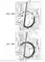 Fig. 40 - Closure element for use with annuloplasty structure