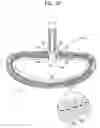 Fig. 44 - Closure element for use with annuloplasty structure