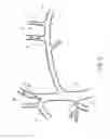 Fig. 02 - Methods and apparatus for treating neurovascular venous outflow obstruction