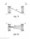 Fig. 06 - Methods and apparatus for treating neurovascular venous outflow obstruction