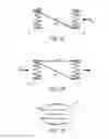 Fig. 07 - Methods and apparatus for treating neurovascular venous outflow obstruction