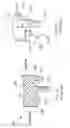Fig. 04 - Method for Optimization of Joint Arthroplasty Component Design