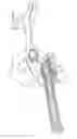 Fig. 01 - Femoral stem and post system for hip prosthesis