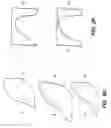 Fig. 08 - Posterior-Stabilized Knee Implant Components and Instruments