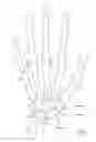Fig. 02 - Total wrist prosthesis and related methods