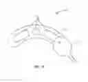 Fig. 06 - Interbody bone implant device
