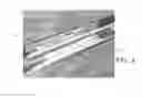 Fig. 04 - Endovascular implant