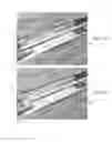 Fig. 25 - Endovascular implant