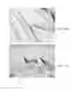 Fig. 29 - Endovascular implant