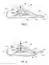 Fig. 02 - APPARATUS AND METHOD FOR DYNAMIC FOOT SUPPORT