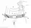 Fig. 01 - Method and apparatus for tensile colonoscopy compression