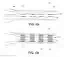 Fig. 07 - DEVICES AND METHODS FOR OCCLUDING A FALLOPIAN TUBE
