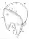 Fig. 01 - Heated Mask Assembly