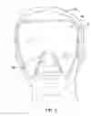 Fig. 05 - Heated Mask Assembly