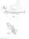 Fig. 08 - System and method for treatment of non-ventilating middle ear by providing a gas pathway through the nasopharynx