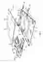 Fig. 02 - Apparatus and system for turning and positioning a patient