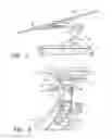 Fig. 06 - ADJUSTABLE HEIGHT MEDICAL PROCEDURE TABLE