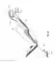 Fig. 32 - Adjustable position limb support for surgical tables, including quick-connect universal boot mount