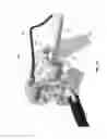 Fig. 35 - Adjustable position limb support for surgical tables, including quick-connect universal boot mount