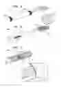 Fig. 03 - Wireless neurostimulators