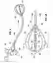 Fig. 02 - Intraluminal tubes with deployable structures and related methods