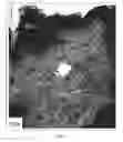 Fig. 08 - PRODUCTS AND METHODS FOR TREATING PERIORBITAL DYSCHROMIA