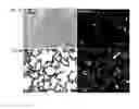 Fig. 06 - LIPOPLEX FORMULATIONS FOR SPECIFIC DELIVERY TO VASCULAR ENDOTHELIUM