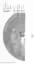 Fig. 02 - NANOPARTICLES FOR CONTROLLED LYSIS OF BLOOD CLOTS
