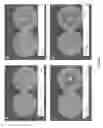 Fig. 02 - Methods and compositions for increasing the potency of antifungal agents