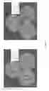 Fig. 10 - Methods and compositions for increasing the potency of antifungal agents