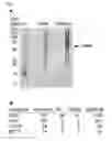 Fig. 02 - Method for assessing the efficacy of IMiDs and composition or combination for use in treating IMiD sensitive diseases