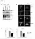 Fig. 09 - Method for assessing the efficacy of IMiDs and composition or combination for use in treating IMiD sensitive diseases