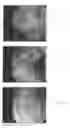 Fig. 02 - MATERIALS AND METHODS FOR TREATMENT AND DIAGNOSIS OF DISORDERS ASSOCIATED WITH OXIDATIVE STRESS