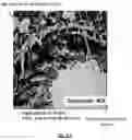 Fig. 06 - COMPOSITIONS AND METHODS FOR TREATING LUNG REMODELING DISEASES