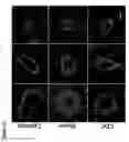 Fig. 12 - CARDIOSPHERE-DERIVED CELLS (CDCS) AS THERAPEUTIC AGENTS FOR PULMONARY HYPERTENSION