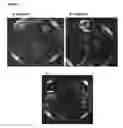 Fig. 28 - METHOD FOR TREATMENT OF DISORDERS OF THE GASTROINTESTINAL SYSTEM