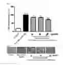 Fig. 04 - Composition including extract of Linne as active ingredient for preventing or ameliorating non-alcoholic fatty liver disease