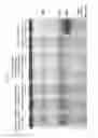 Fig. 02 - Lentiviral vector for treating hemoglobin disorders