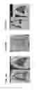 Fig. 22 - Methods for treating plague