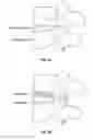 Fig. 09 - Joint replacement or joint resurfacing devices, systems and methods