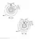 Fig. 09 - DEVICES FOR INTRALUMINAL SENSING