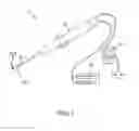 Fig. 02 - Medical catheter with deflection pull ring and distal tip attachment apparatus