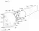 Fig. 01 - Weeping balloon devices
