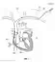 Fig. 02 - Weeping balloon devices