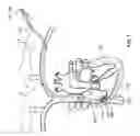 Fig. 02 - BALLOON CATHETER VISUALIZATION DEVICE INCLUDING REINFORCEMENT FEATURES