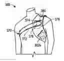 Fig. 01 - Apparatus and Methods for Charging an Implanted Medical Device Power Source