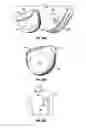 Fig. 08 - Apparatus and Methods for Charging an Implanted Medical Device Power Source